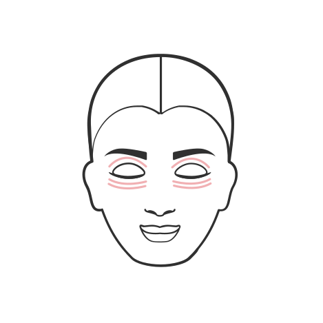 Upper-Lower-Blepharoplasty_1